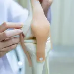 Chirurgo ortopedico: la riabilitazione dopo un intervento di protesi al ginocchio